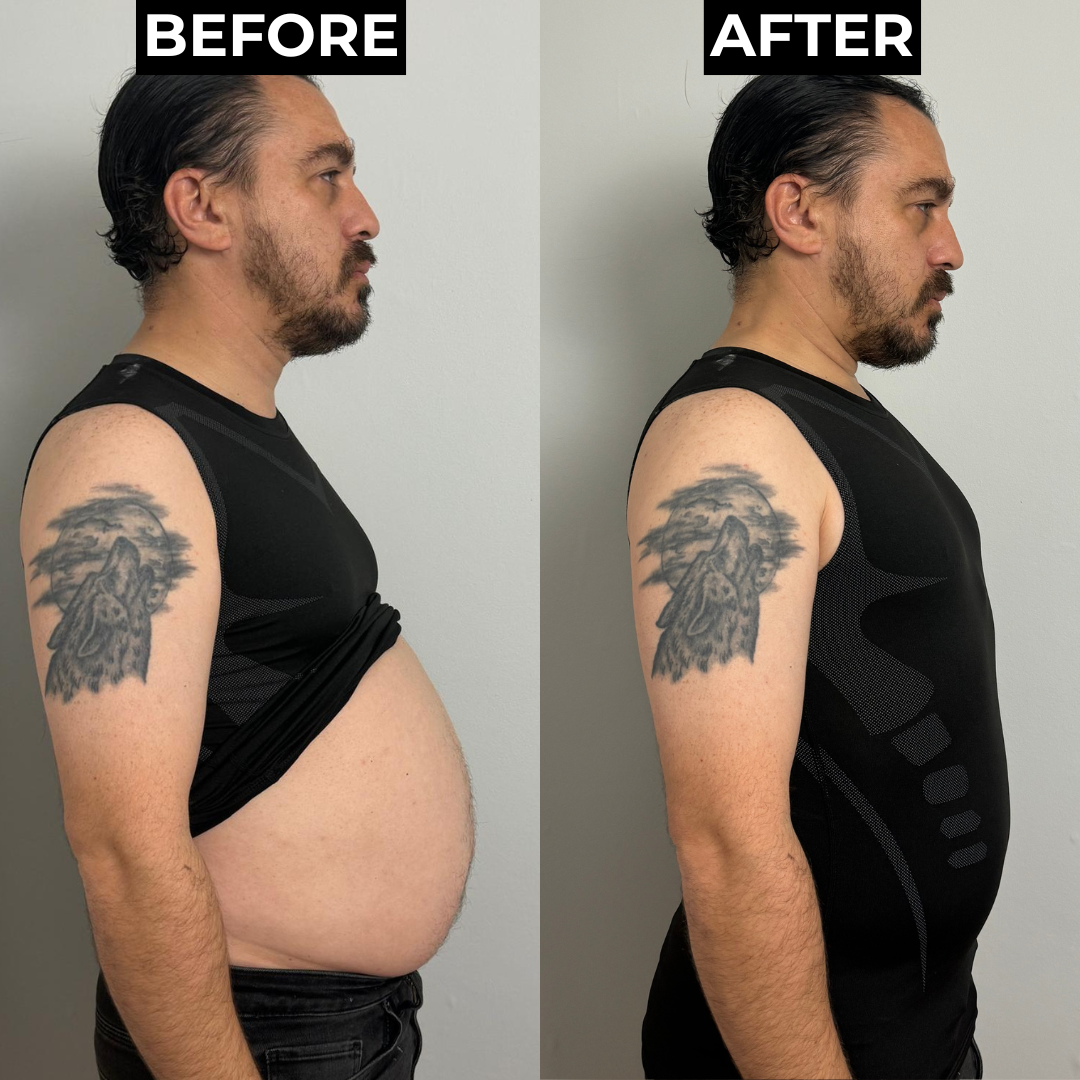 SlimFlex | Feel The Power of Confidence, Shape & Control